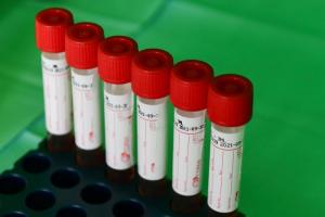 ‘मोबाइल टेस्टिंग पॉड