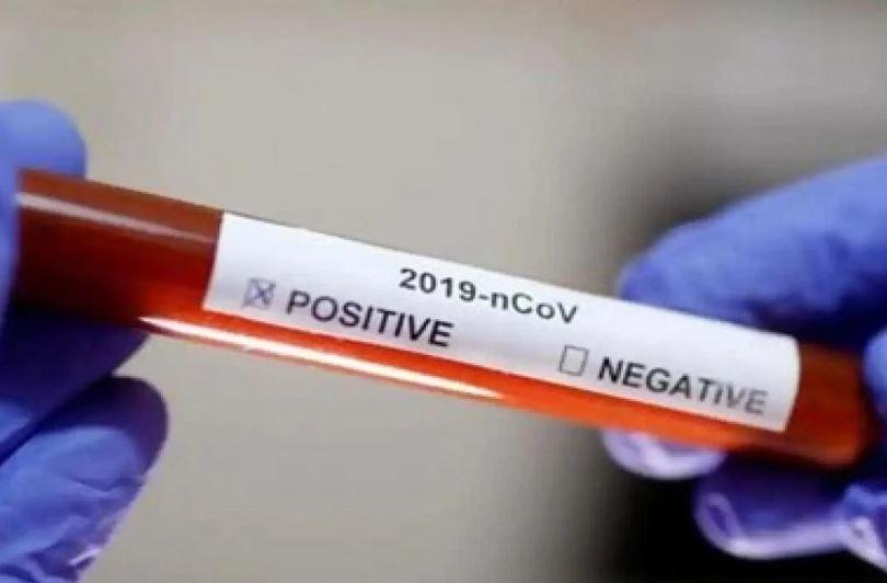 coronavirus