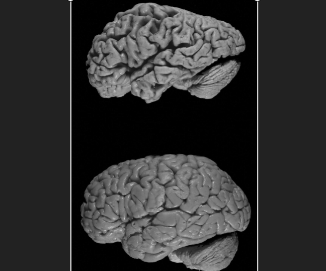 mind