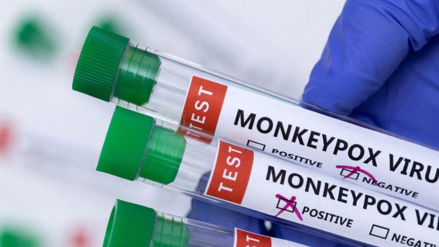 Monkeypox
